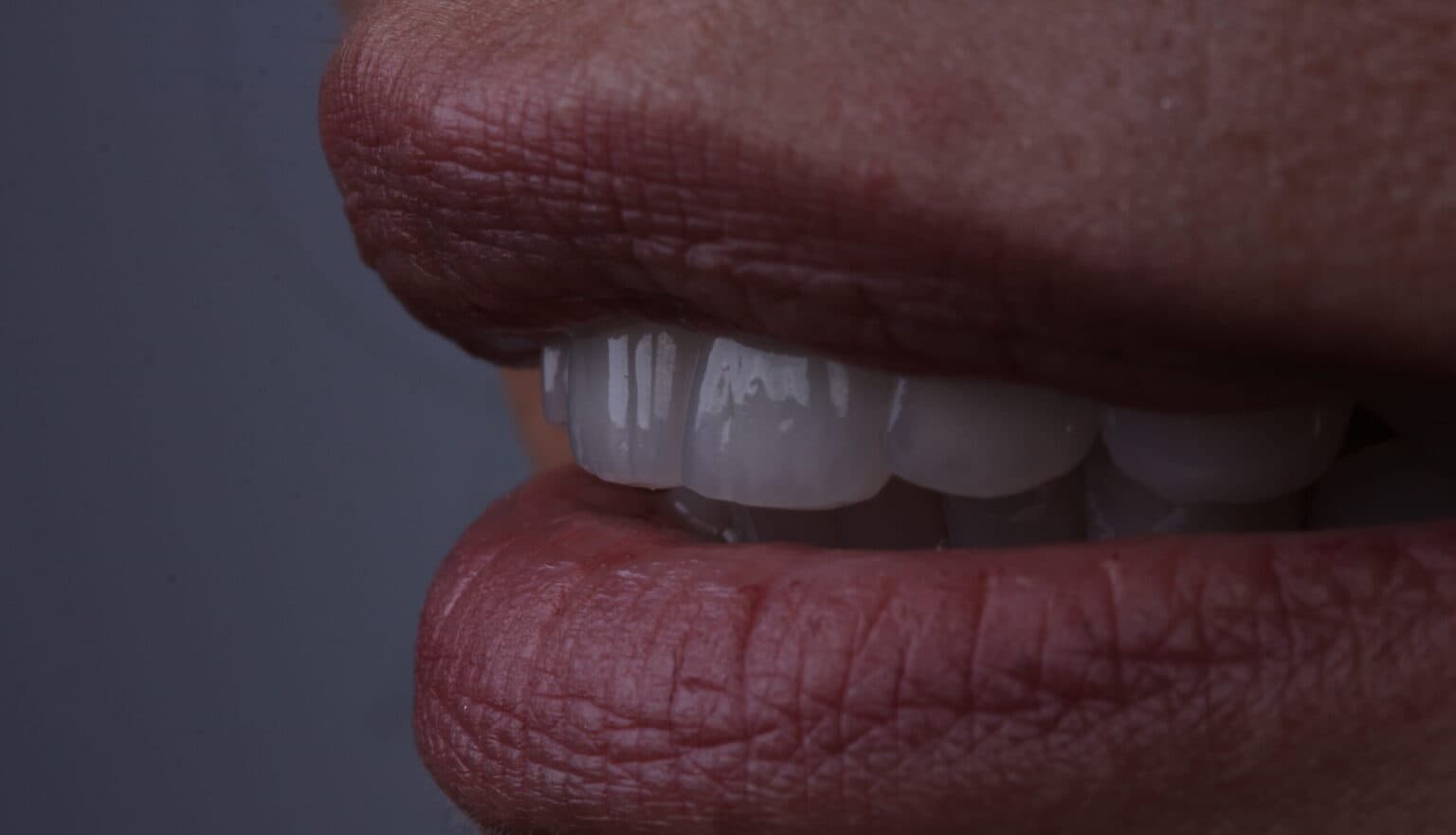 MG Dental Clinic